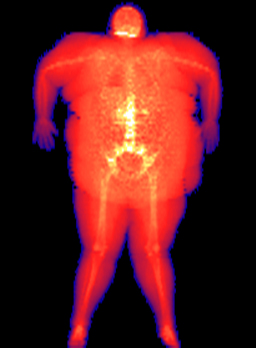 Amanda Elite Composite